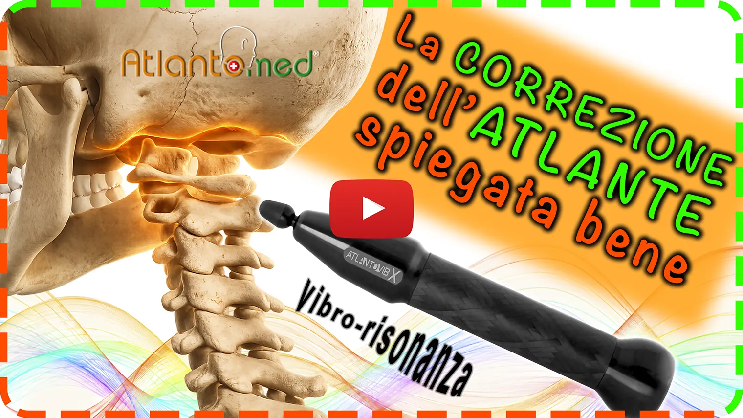 Riallineamento dell'Atlante